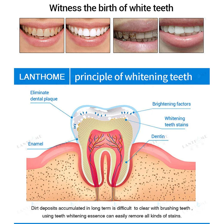 Teeth Whitening Pens