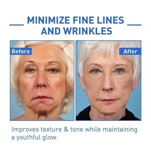 Last Day Promotion 70% OFF - đ„Botox Face Serum