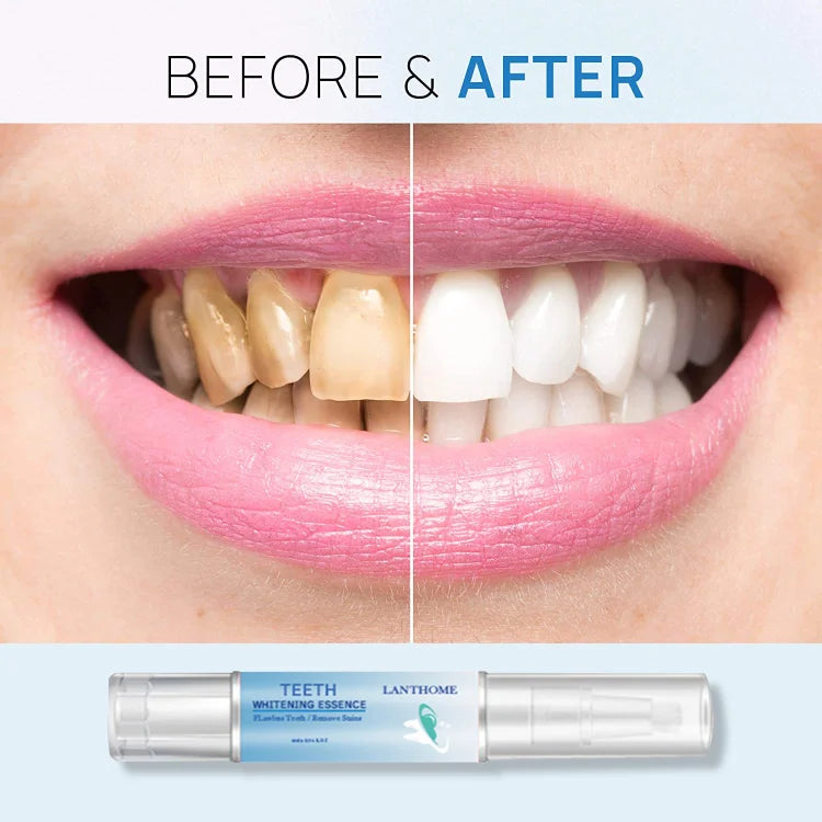 Teeth Whitening Pens