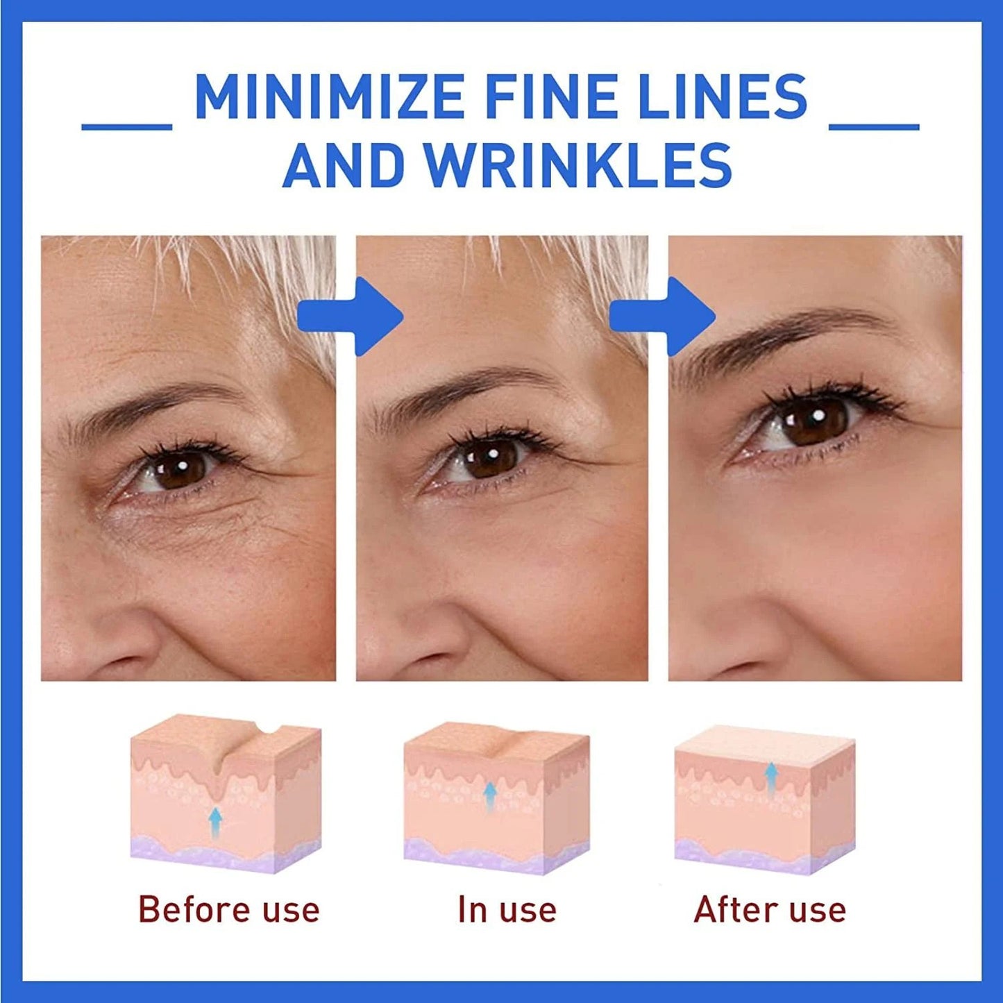 Last Day Promotion 70% OFF - đ„Botox Face Serum