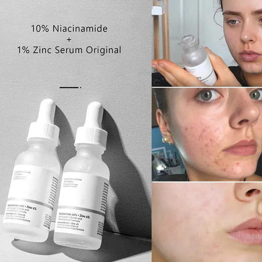 Original Niacinamide 10% + Zinc 1% B5 Essence Fruit Acid 30% Salicylic Caffeine Vitamin Moisturizes Tightens Soften Skin Care