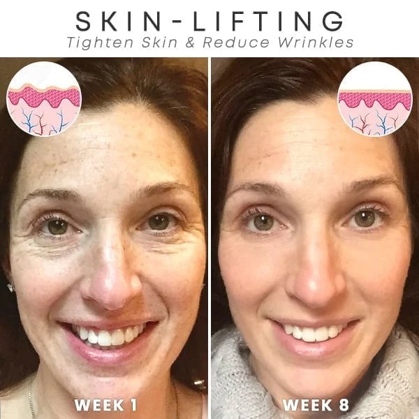 Last Day Promotion 70% OFF - đ„Botox Face Serum