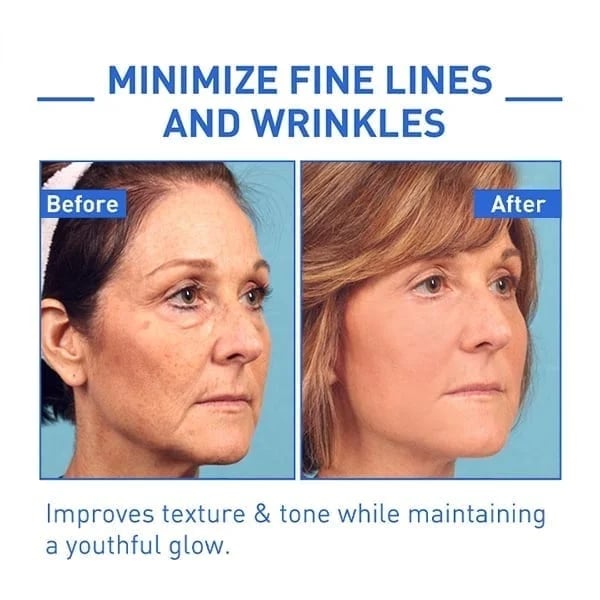 Last Day Promotion 70% OFF - đ„Botox Face Serum