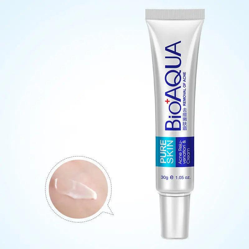 Acne Cream: Oil Control, Pore Shrink, Scar Remove