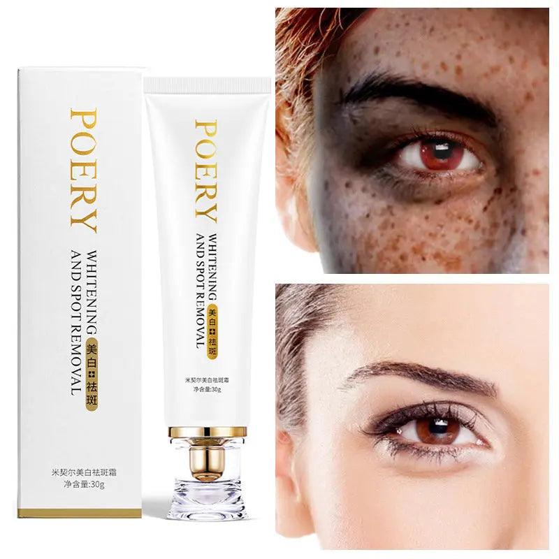 Whitening & Freckle Cream: Spot Reduction & Moisturizing