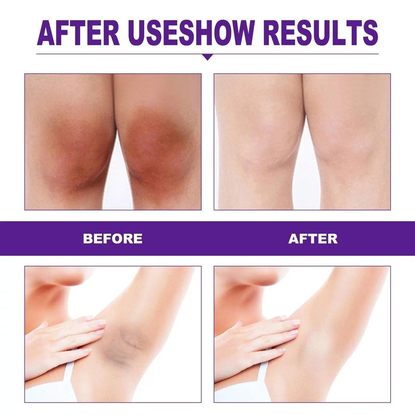 Private Parts Whitening Cream