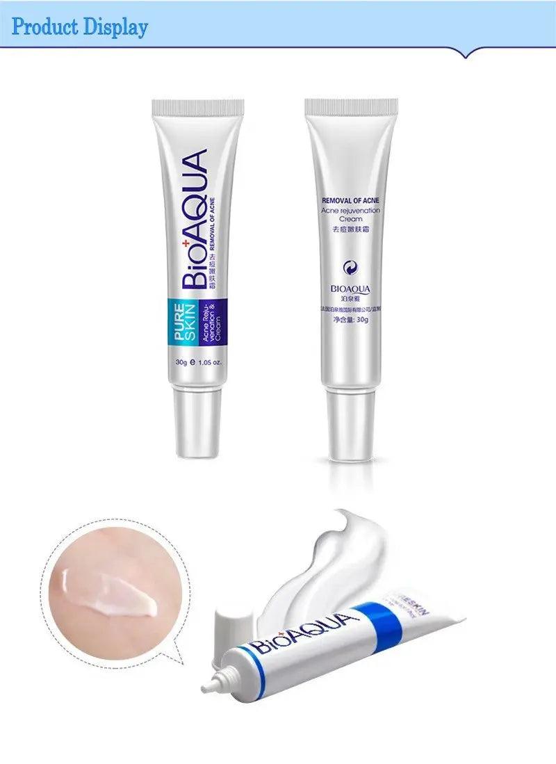 Acne Cream: Oil Control, Pore Shrink, Scar Remove