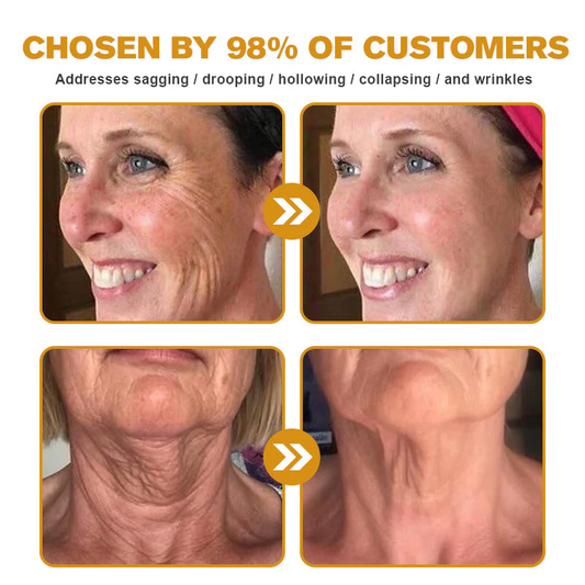 Botox Bee Venom Wrinkle Removal Cream