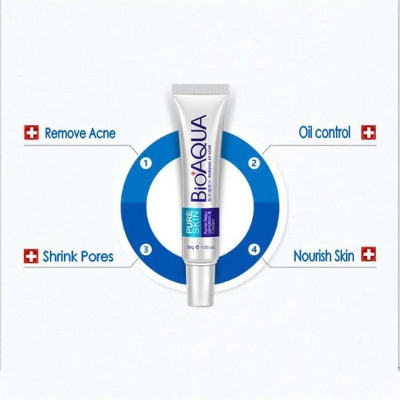 Acne Cream: Oil Control, Pore Shrink, Scar Remove