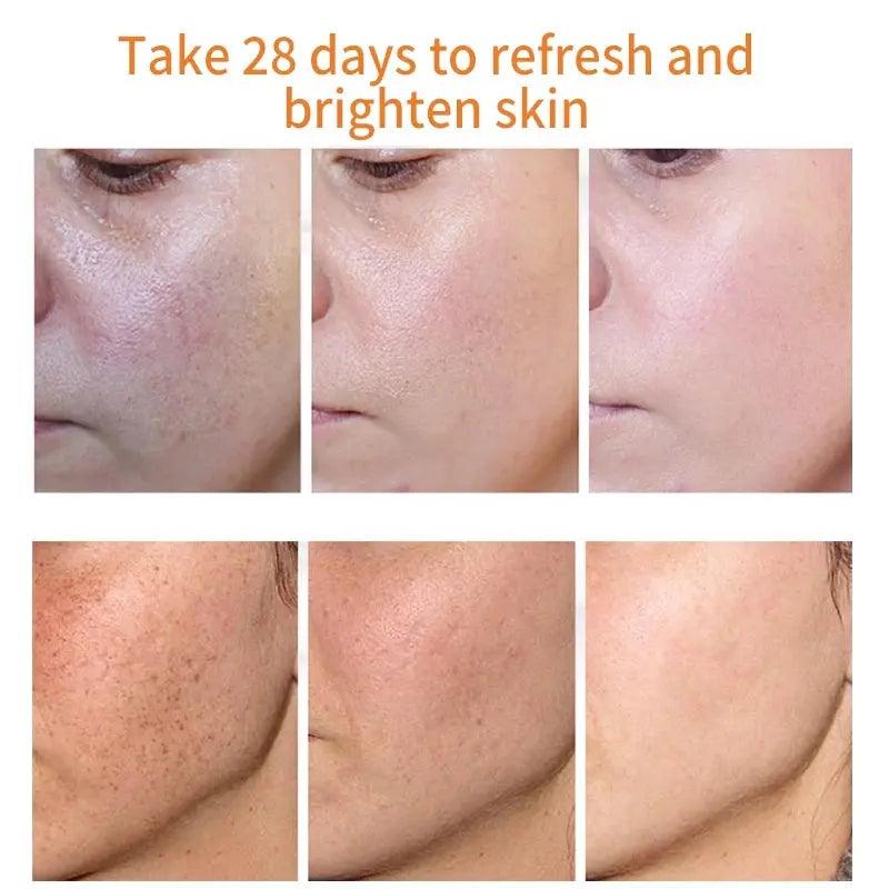 Whitening & Freckle Cream: Spot Reduction & Moisturizing