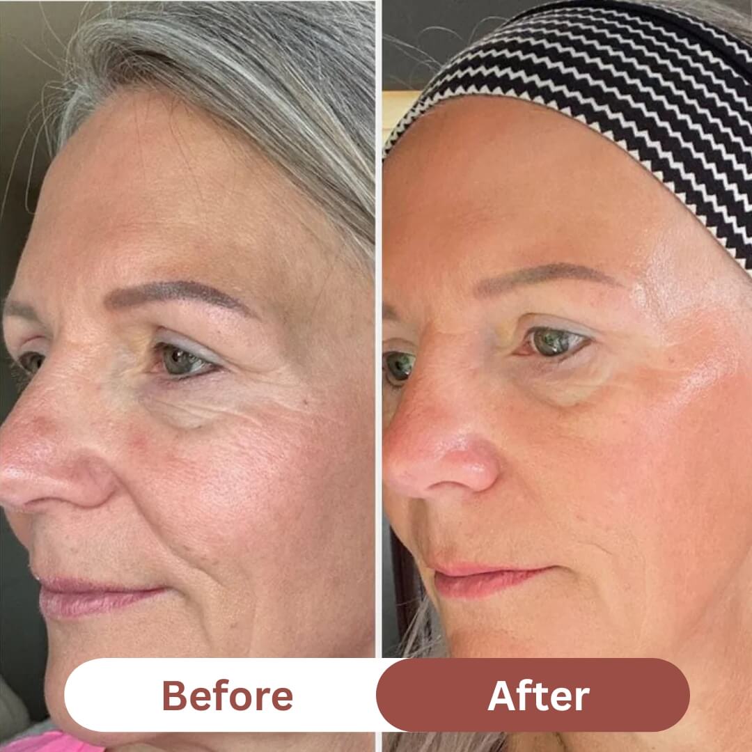 Beautiva™Collagen Mask
