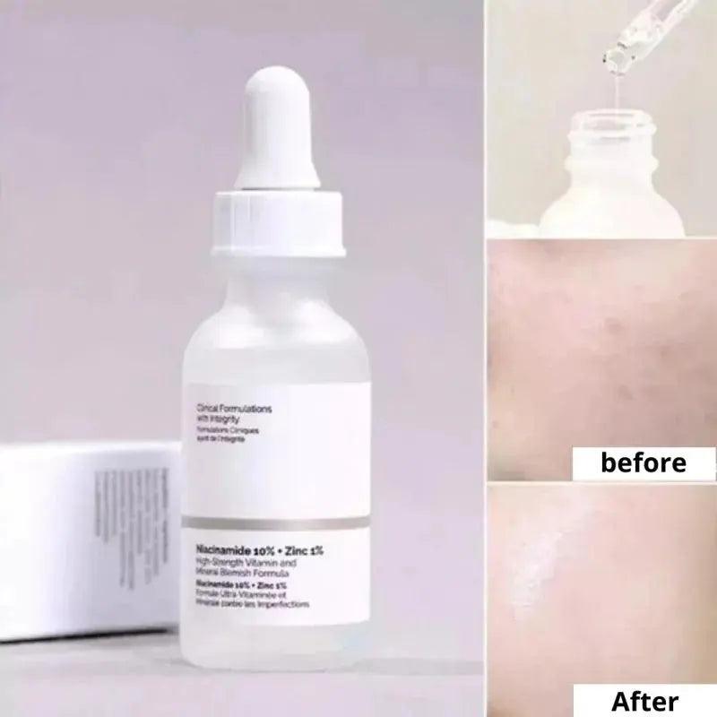 Original Niacinamide 10% + Zinc 1% B5 Essence Fruit Acid 30% Salicylic Caffeine Vitamin Moisturizes Tightens Soften Skin Care