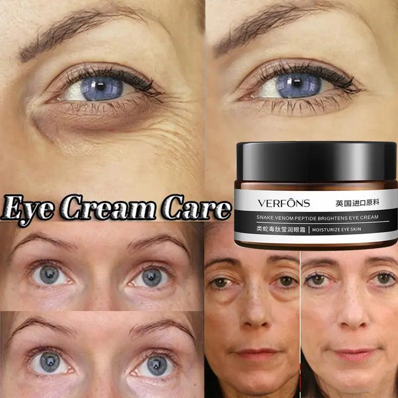 Firming Eye Cream: Dark Circle Remover & Moisturizing