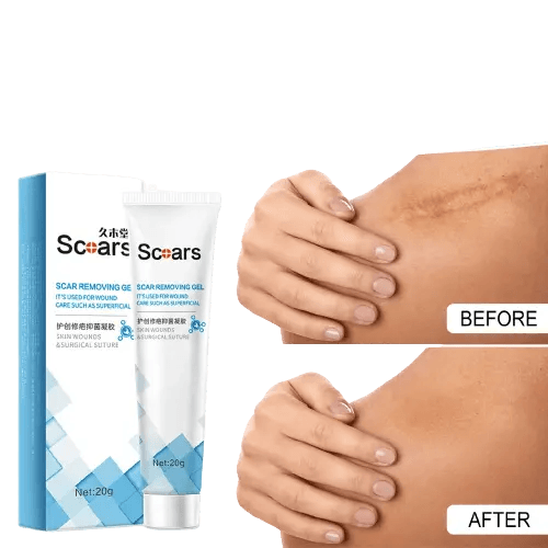 New Herbal Scar Repair Cream
