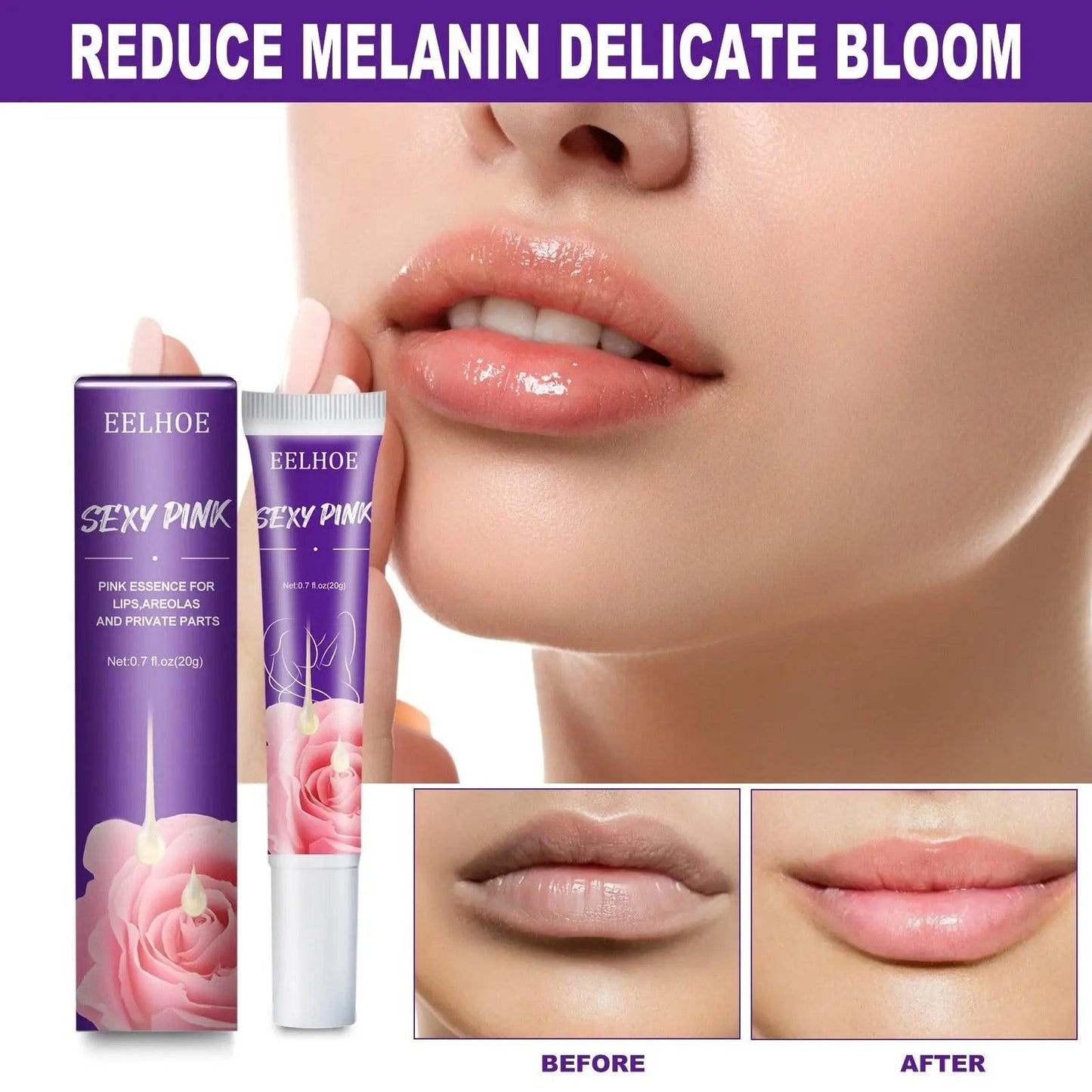Private Parts Whitening Cream
